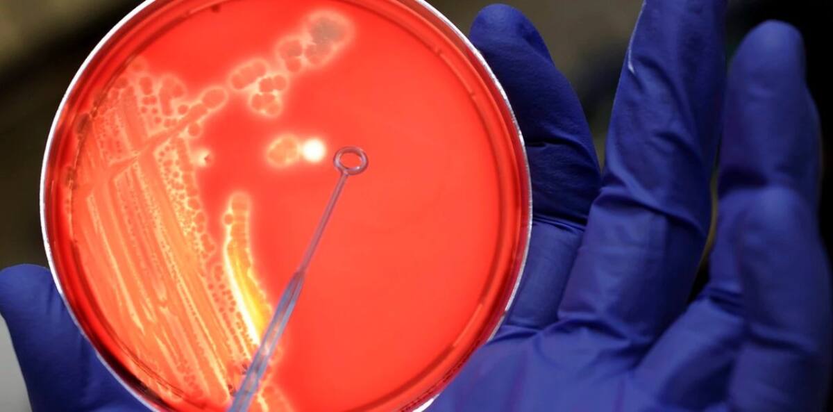 Bacterias en análisis de la Escherichia coli. Foto: EFE