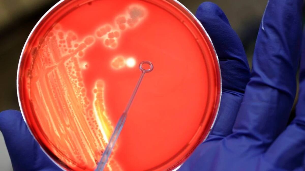 Bacterias en análisis de la Escherichia coli. Foto: EFE