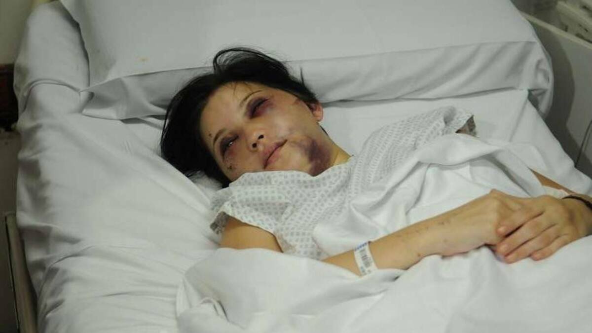 Belén Torres - Golpeada por anestesista