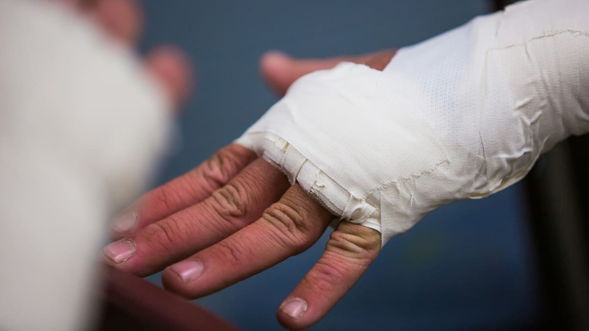 Se quebró un brazo en Miami, la asistencia al viajero le negó parte de la cobertura y terminó condenada a pagar una multa millonaria