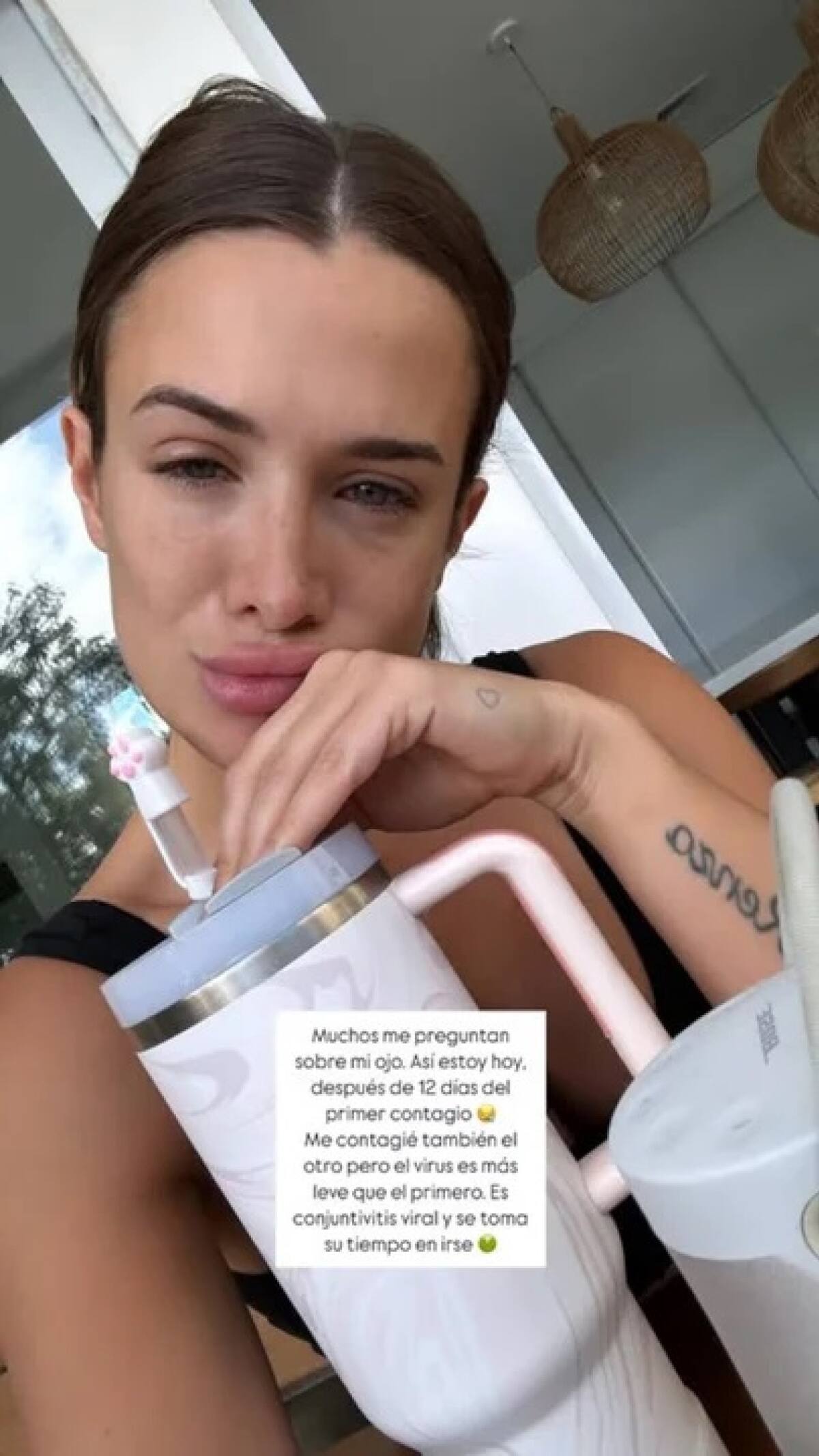 Camila Homs reveló la situación de salud que atraviesa. Foto: NA.