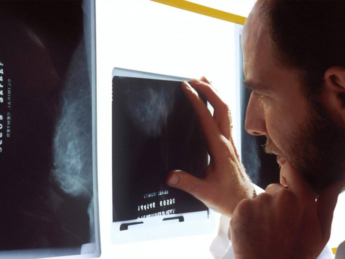 Cáncer colorrectal, salud, Reuters