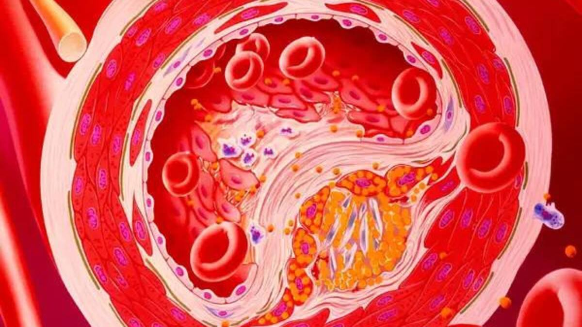 Cáncer de próstata, salud