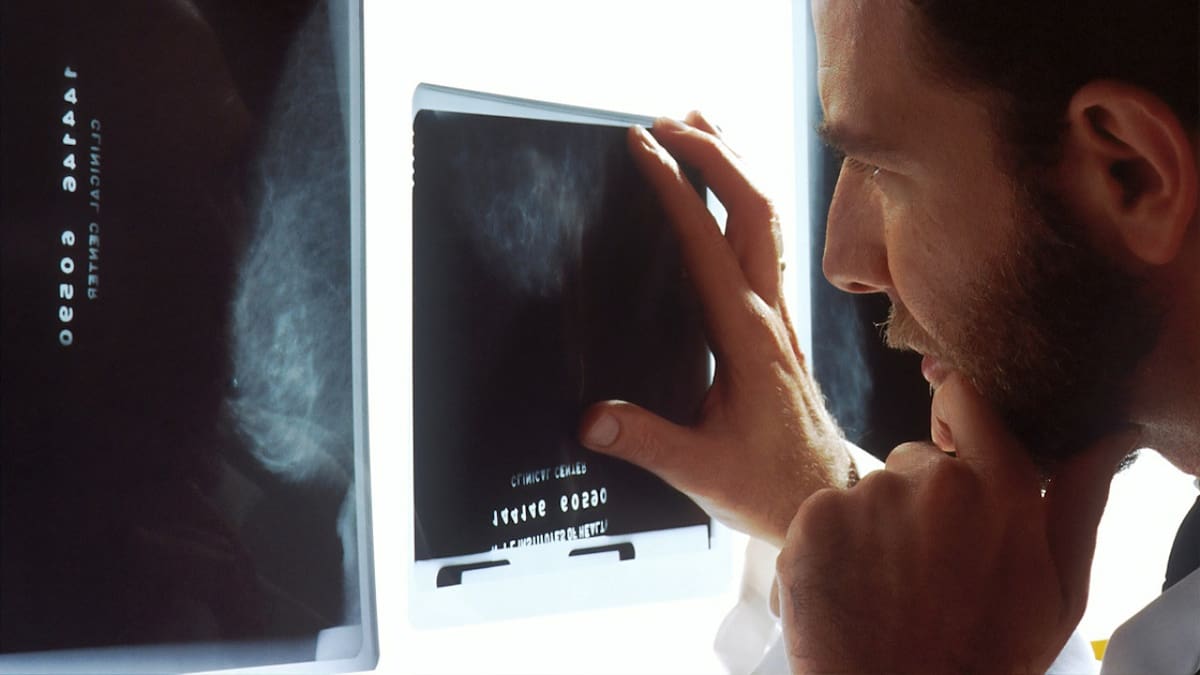 Cáncer; médico. Foto: Unsplash.