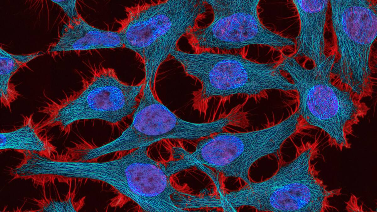 Cáncer pélvico. . Foto: Unsplash