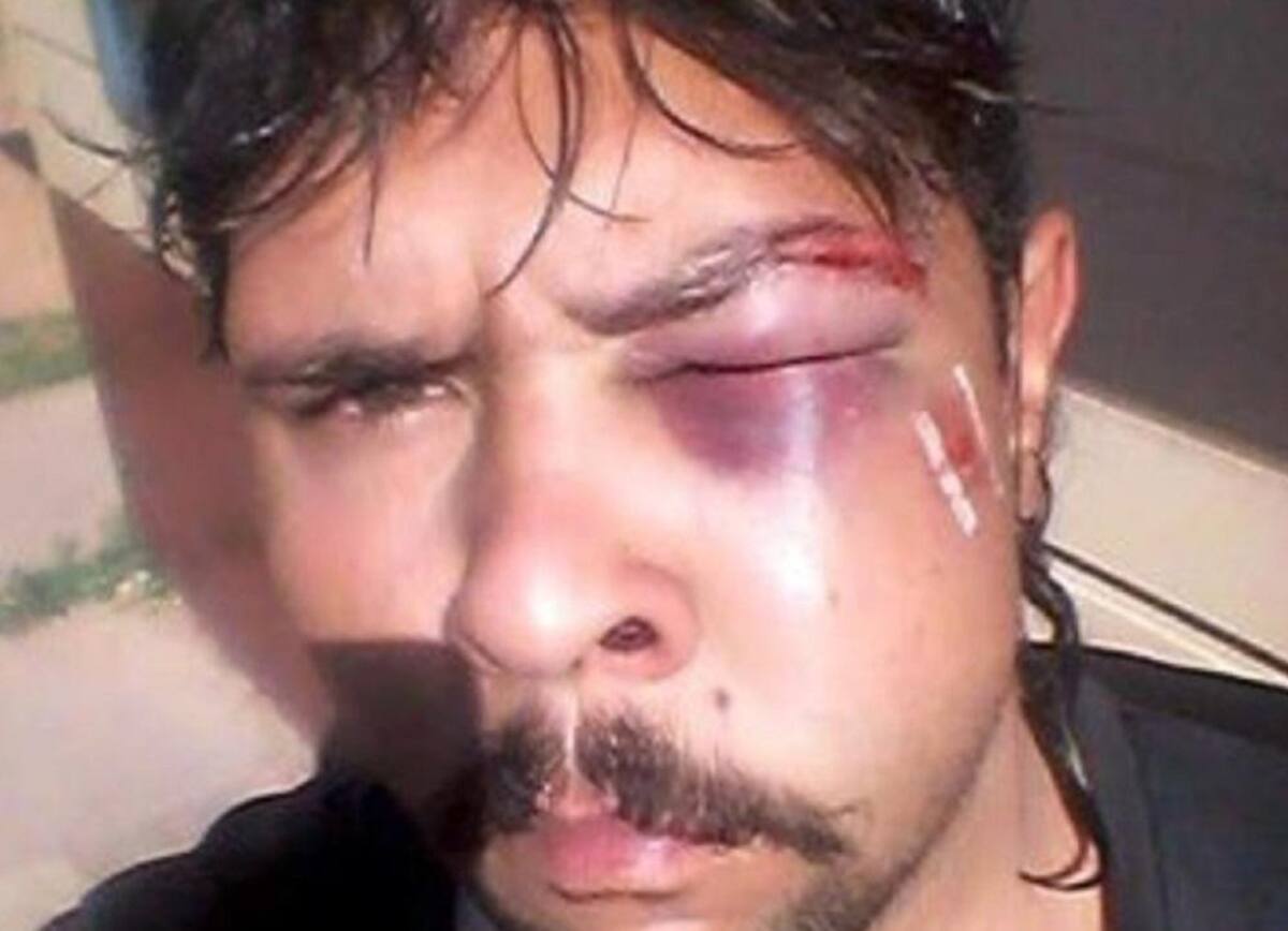 Canguro golpeó a joven en Australia