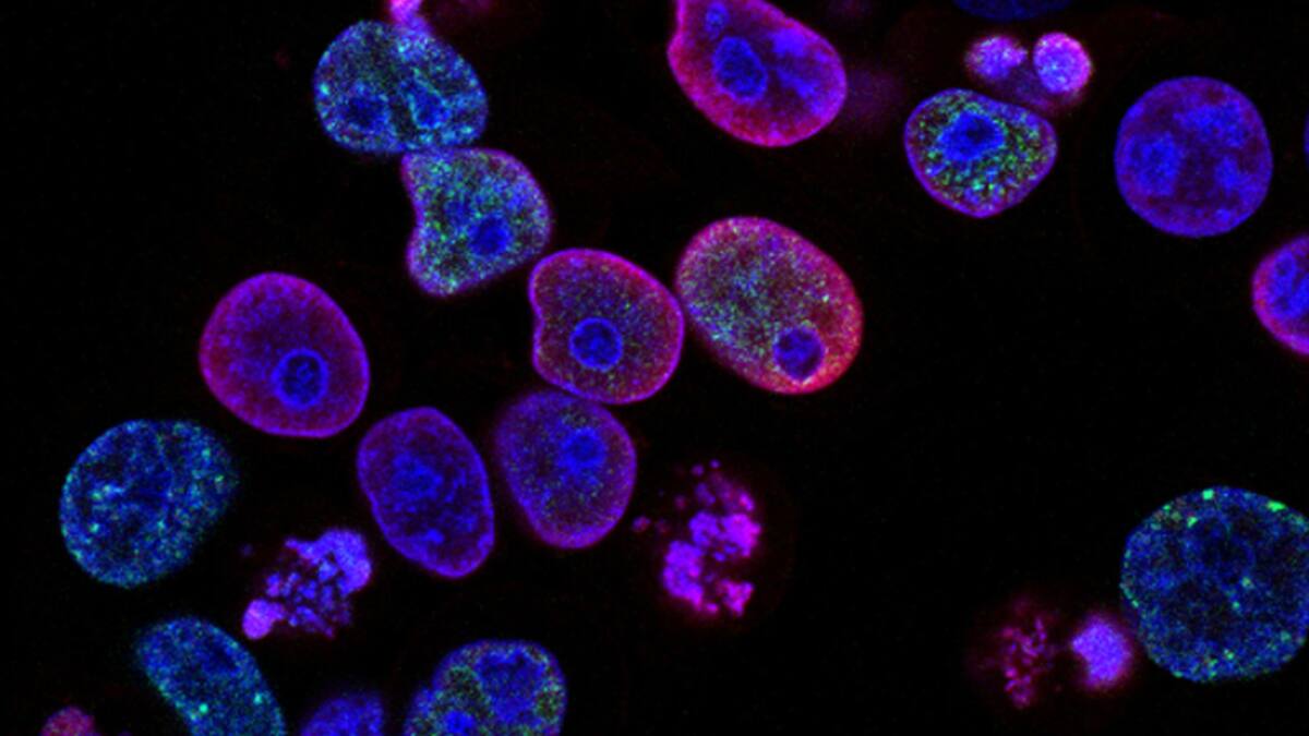 Células de cancer. Foto: Unsplash