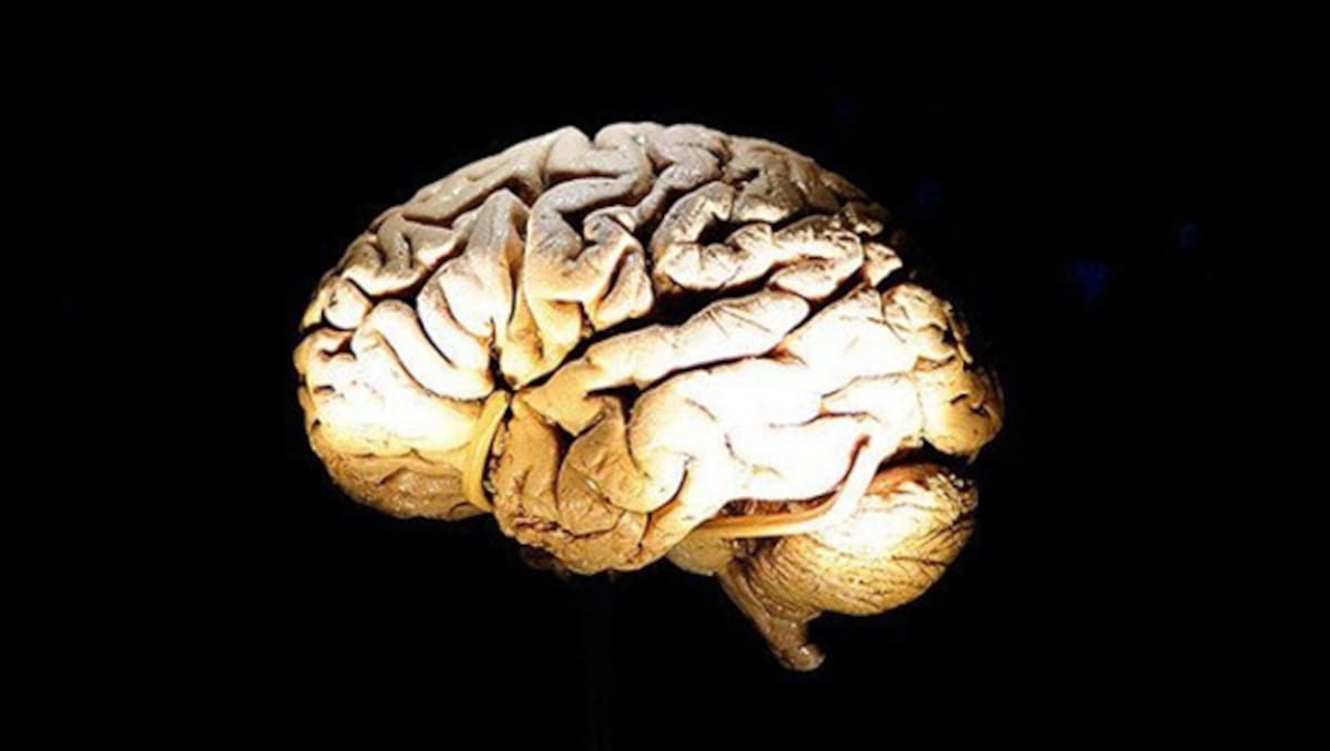Cerebro