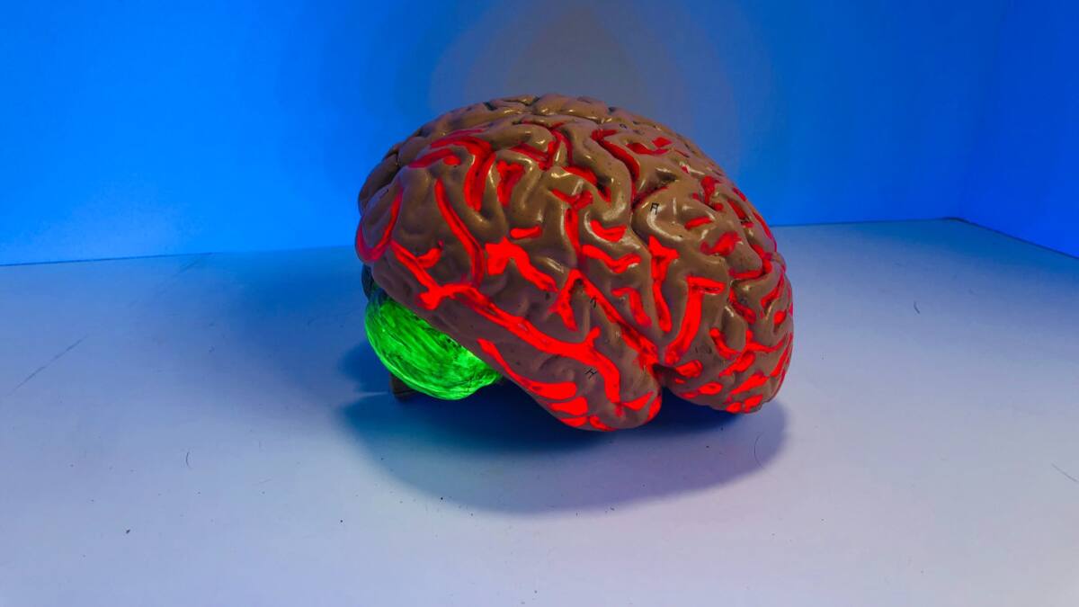 Cerebro. Foto Unsplash.