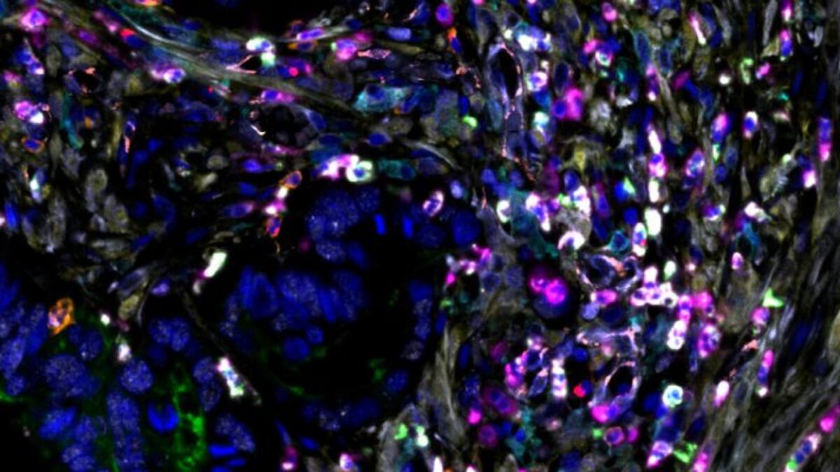 Científicos de Argentina descubren tratamiento para frenar el crecimiento de tumores. Foto: Conicet.