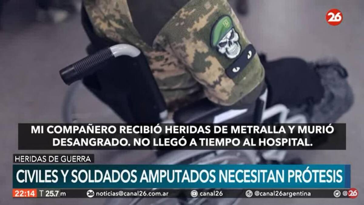 Civiles y soldados amputados necesitan prótesis: otra consecuencia de la invasión de Putin a Ucrania