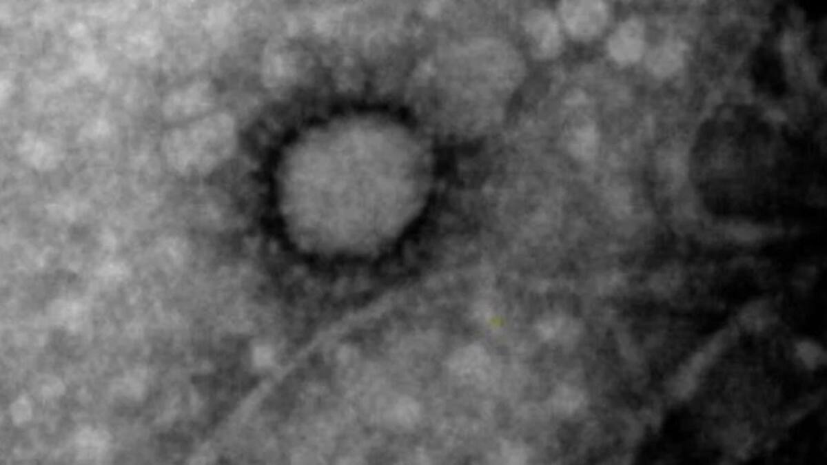 Coronavirus, Argentina, primera foto del virus circulante