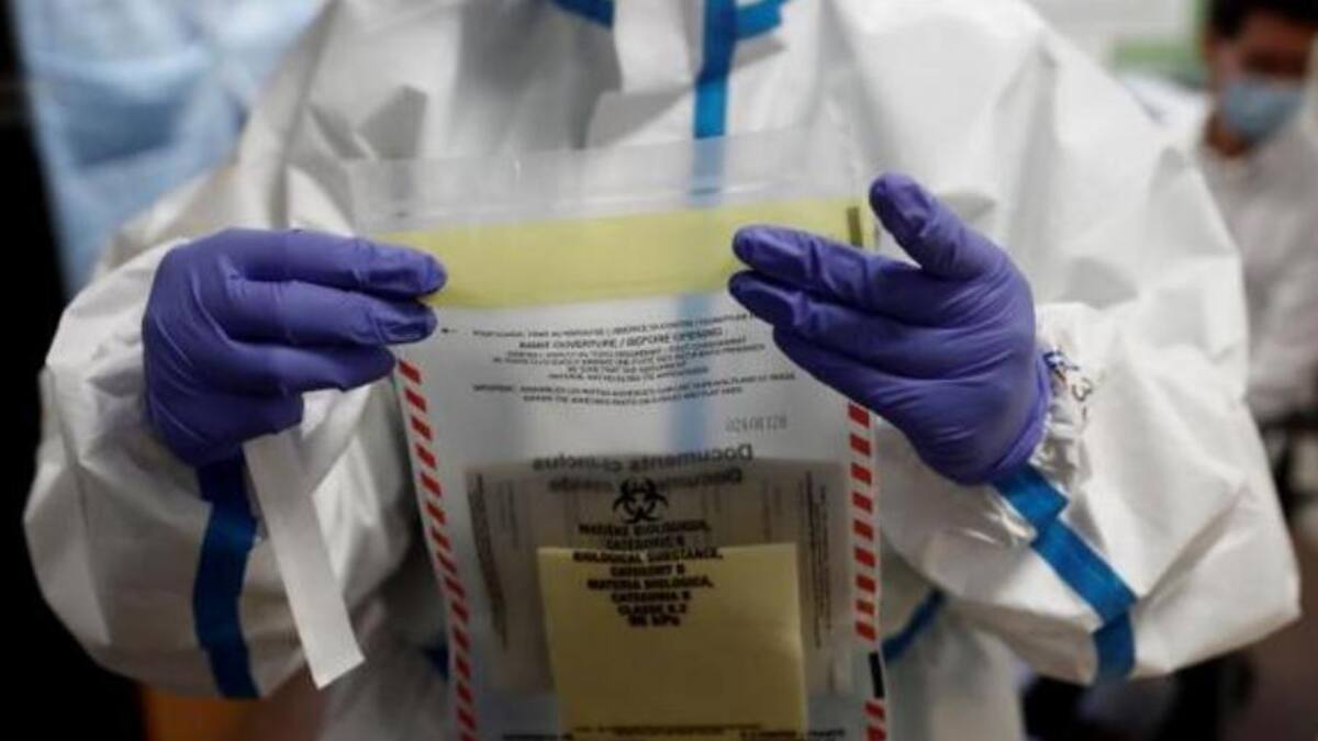 Coronavirus en EEUU, test