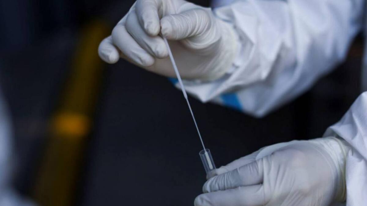 Coronavirus, test, foto Reuters