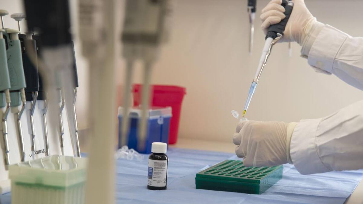 Covid-19, coronavirus en Argentina, laboratorio, clínica, NA