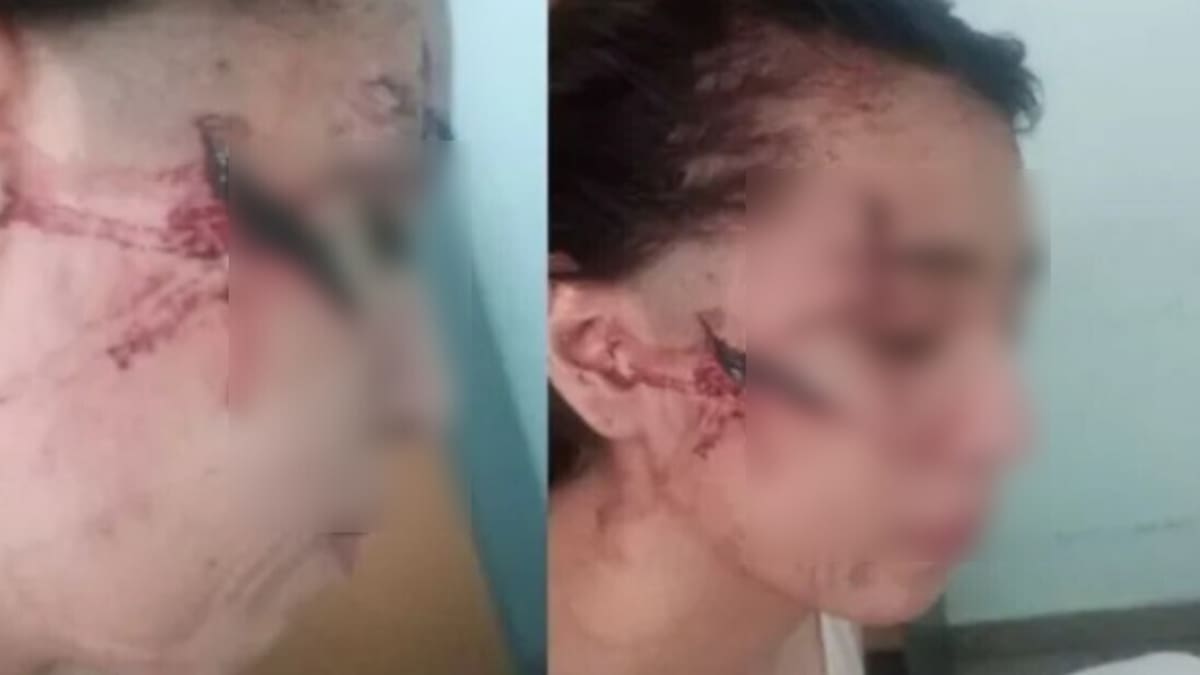 Antecedentes de la tragedia de Santa Fe: una alumna terminó con la cara desfigurada por un elemento punzante en San Cristóbal