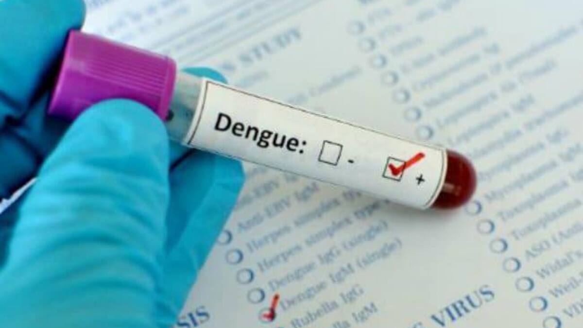 Dengue, análisis en laboratorio, estudios