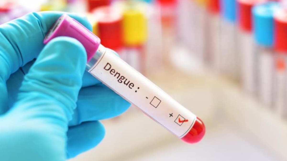 Dengue, enfermedad. Foto: NA