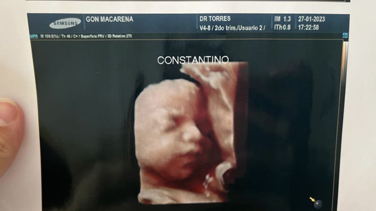 Denuncian a una clínica por entregar la misma foto de la ecografía 5D a todas las pacientes. Foto: Twitter.