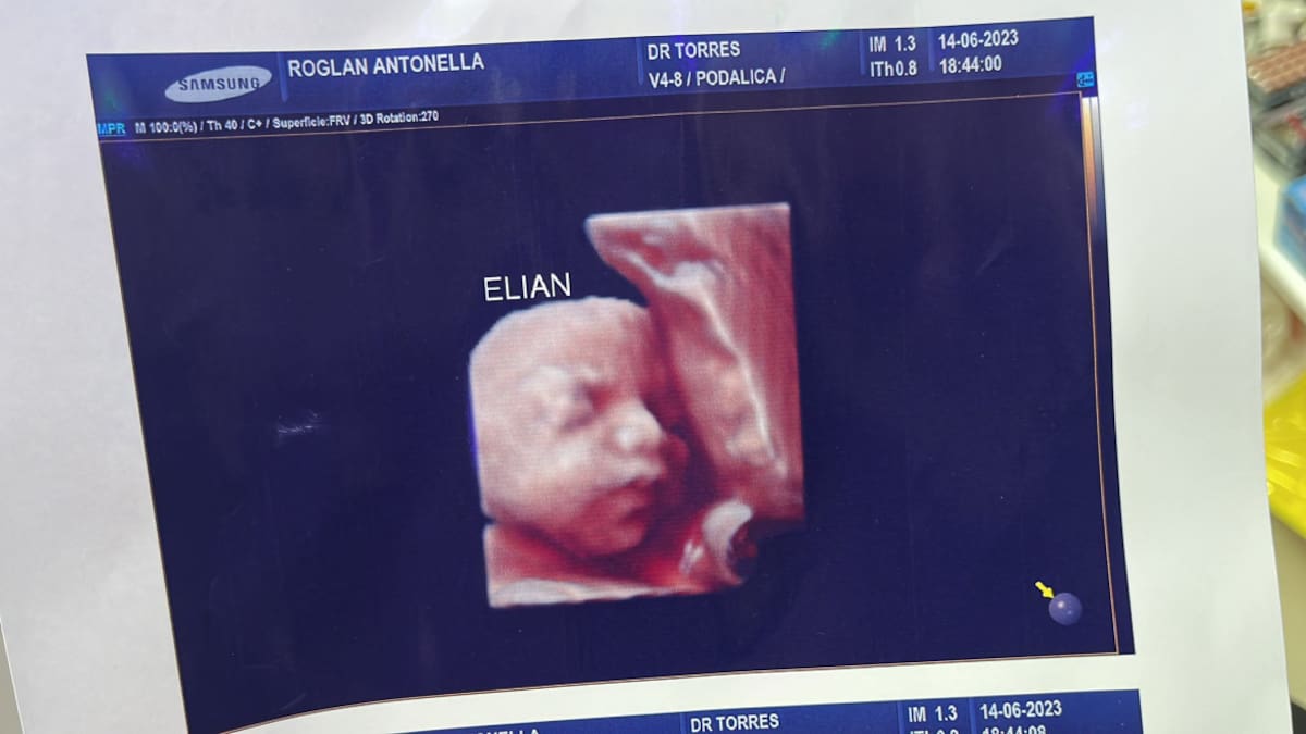 Denuncian a una clínica por entregar la misma foto de la ecografía 5D a todas las pacientes. Foto: Twitter.