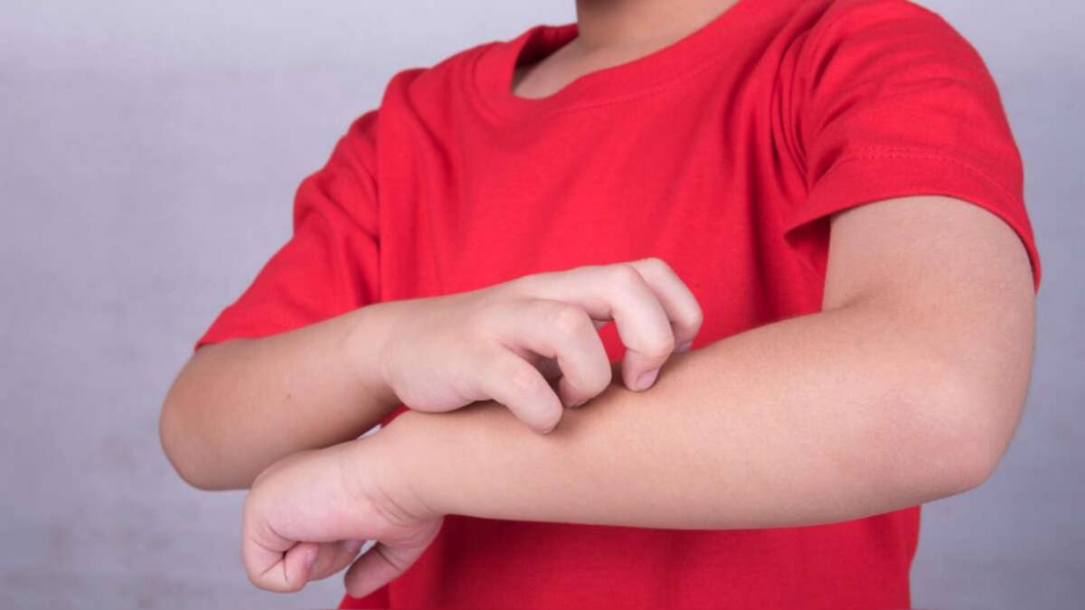 Dermatitis atópica, enfermedad de la piel, salud