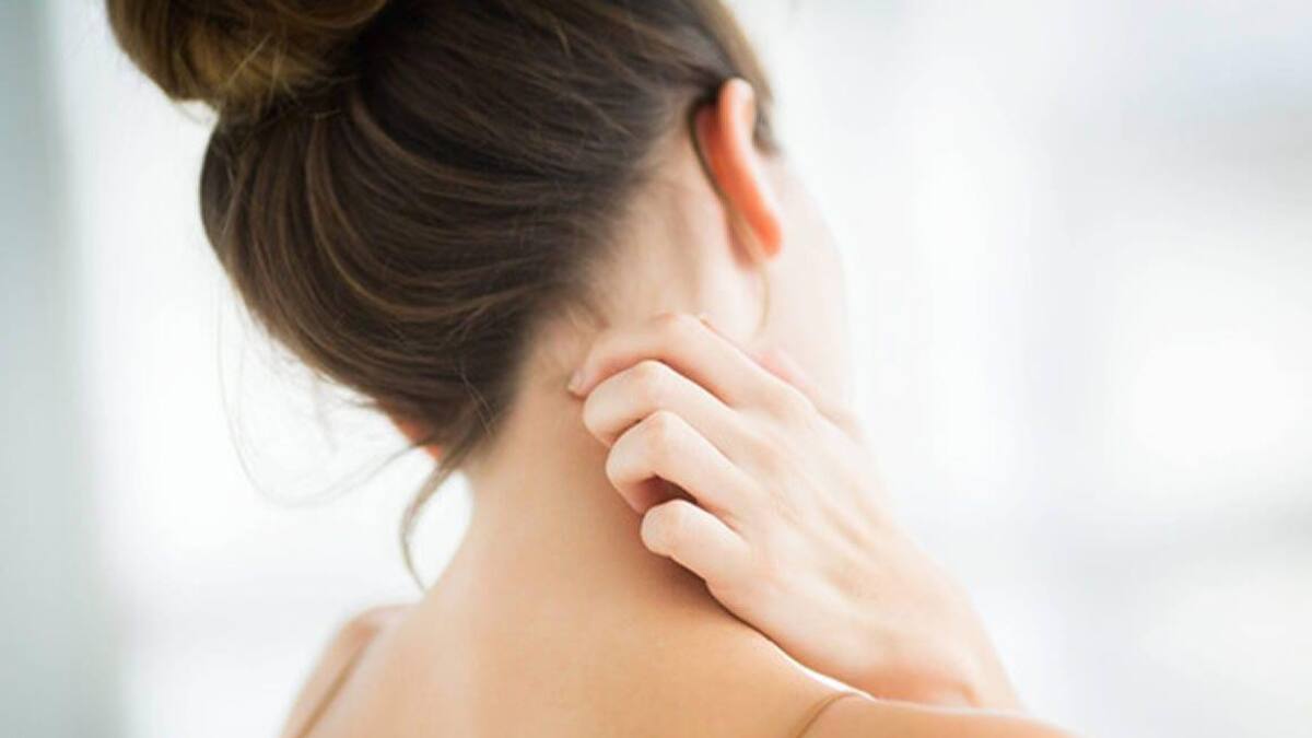 Dermatitis atópica, enfermedad de la piel, salud