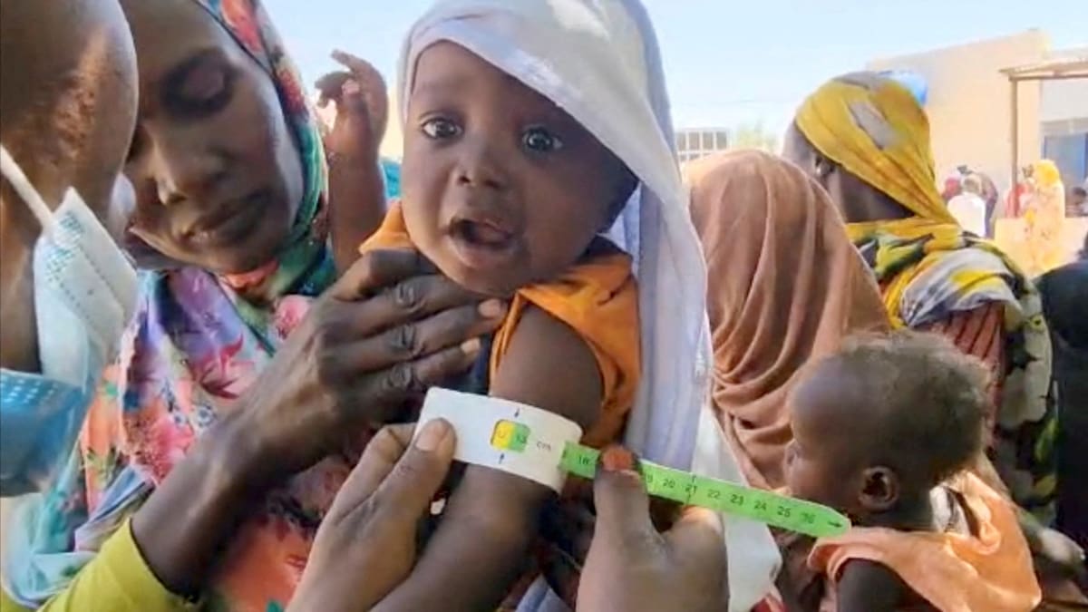 Desnutrición en África, el flagelo que padece la población de este continente. Foto: Reuters.