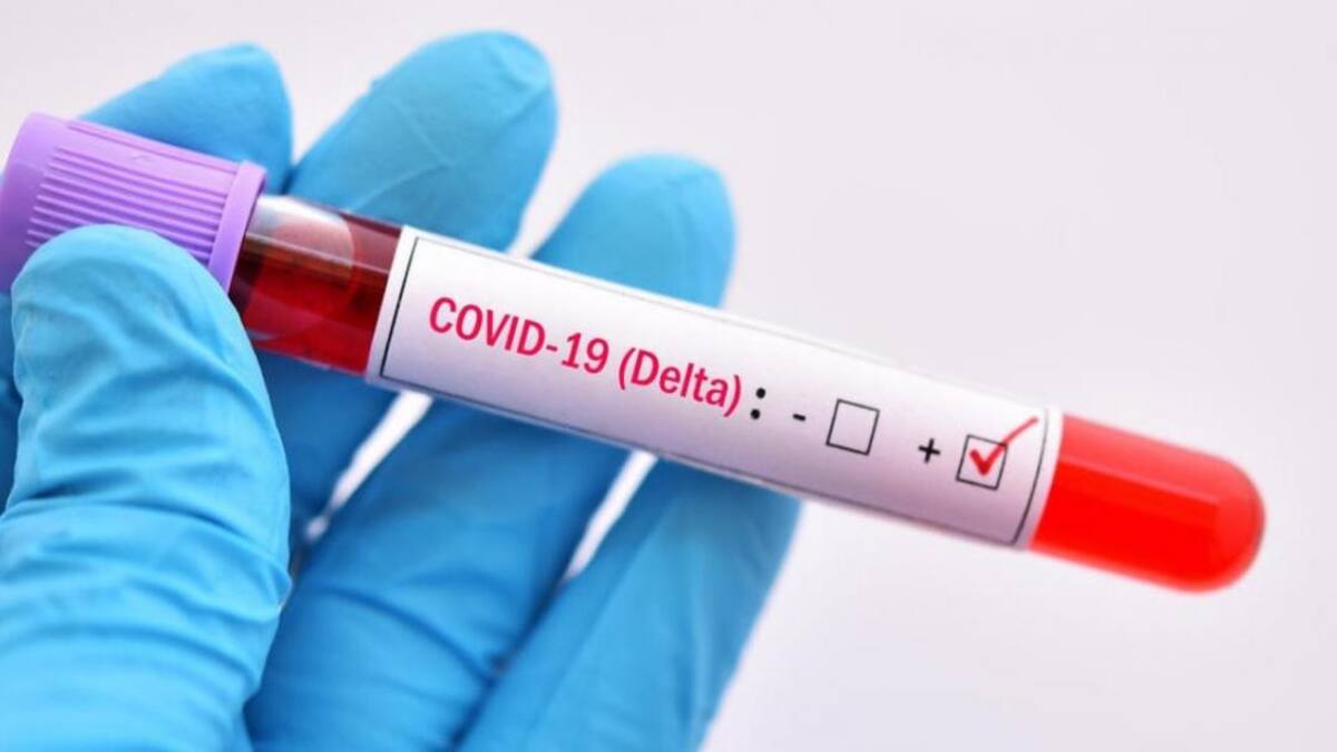 Dos estudios confirman la mayor peligrosidad de la Variante Delta: le adjudican un riego de muerte 137% mayor