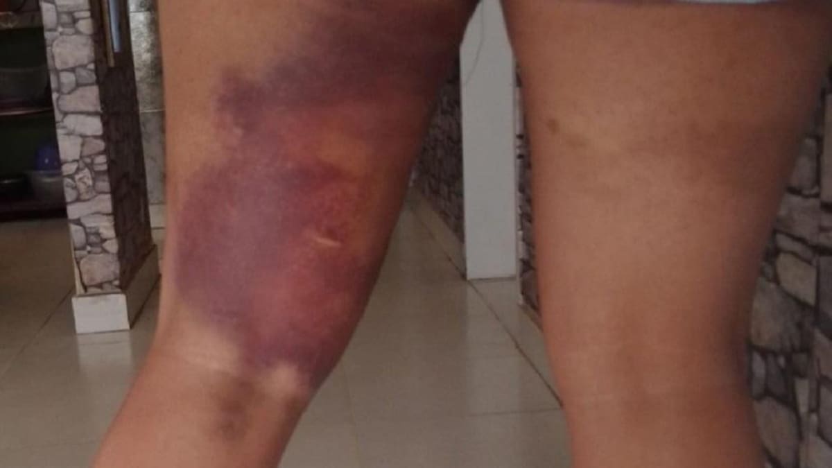 Dos mujeres chocaron, discutieron y una atropelló a la otra, NA