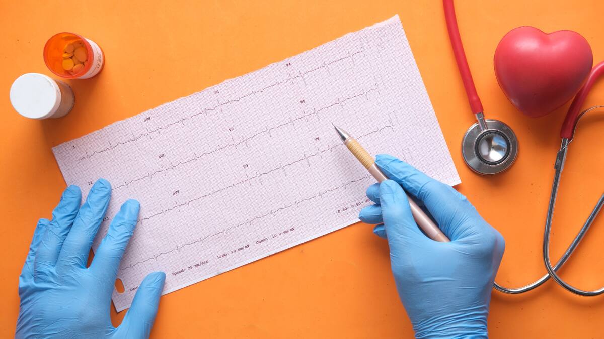 El calor extremo podría poner en riesgo la salud cardiovascular. Foto: Unsplash