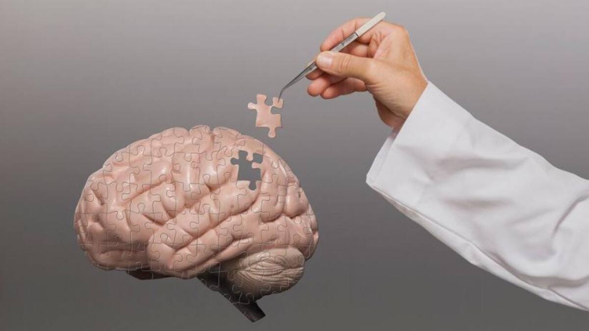 ELA,enfermedad. Foto: EFE.