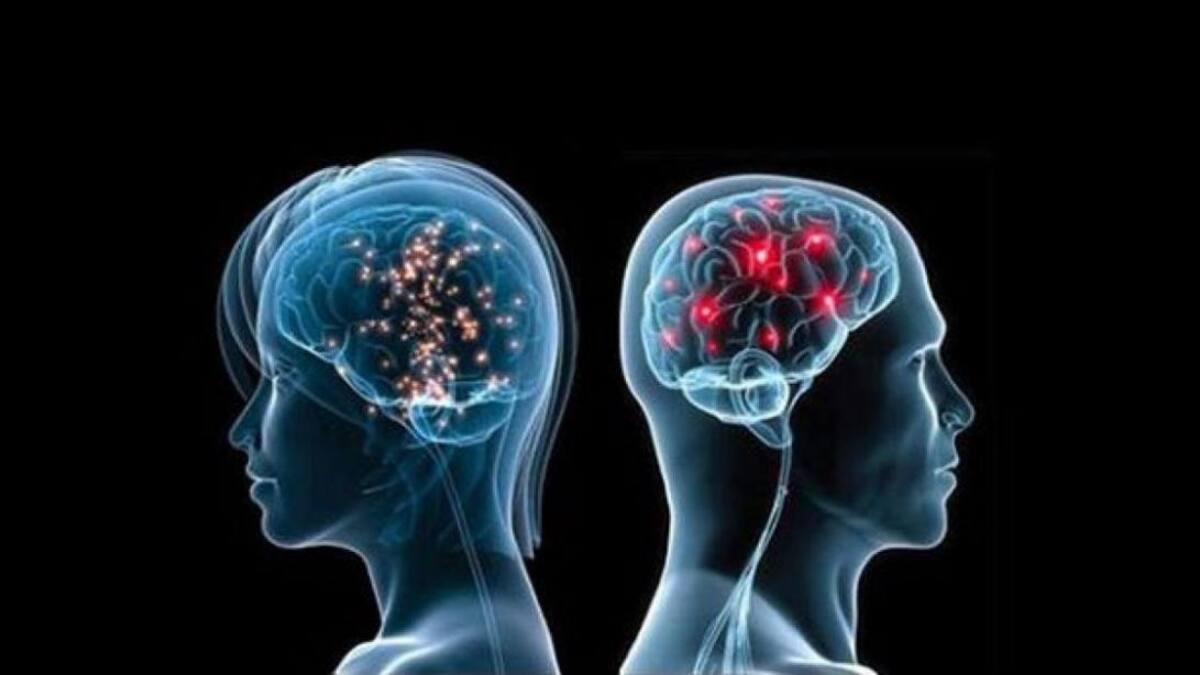Enfermedad neurológica, cerebro, Parkinson, accidente cerebrovascular (ACV), demencia