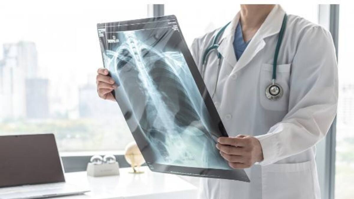 EPOC, una de las enfermedades más mortales del mundo. Foto: Télam