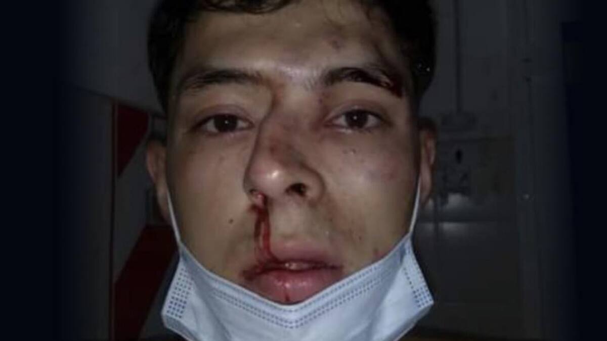 Estudiante de periodismo atacado en Chaco, NA, Twitter