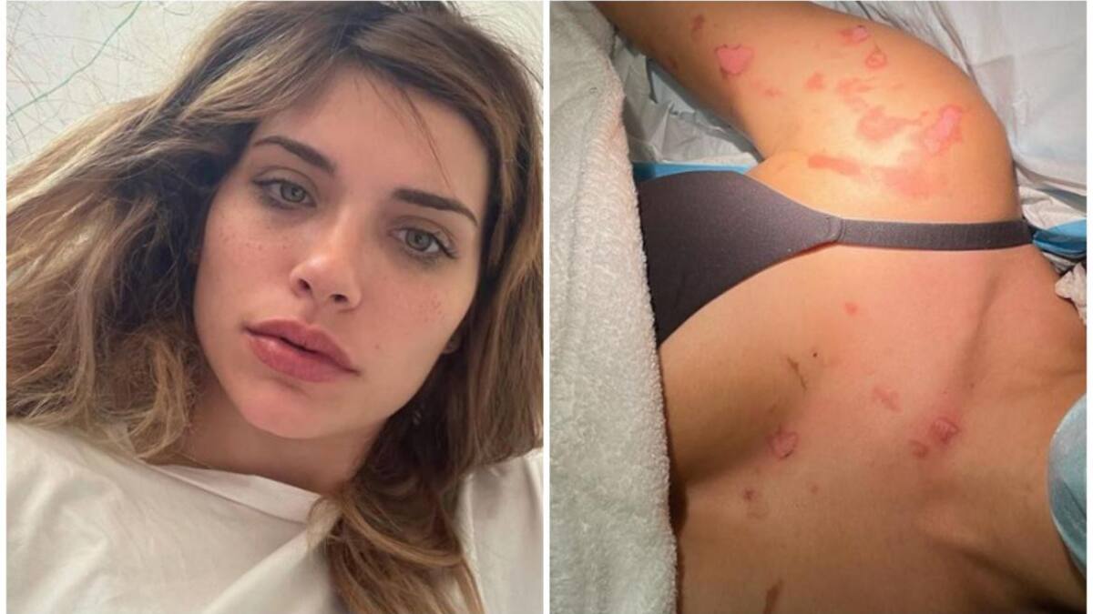 Eva De Dominici recordó el accidente que sufrió. Fotos: Instagram