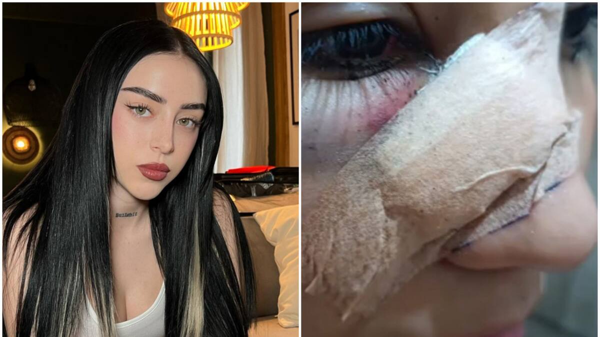 Fan de Nicki Nicole terminó herida por un botellazo. Fotos: Instagram - captura video.