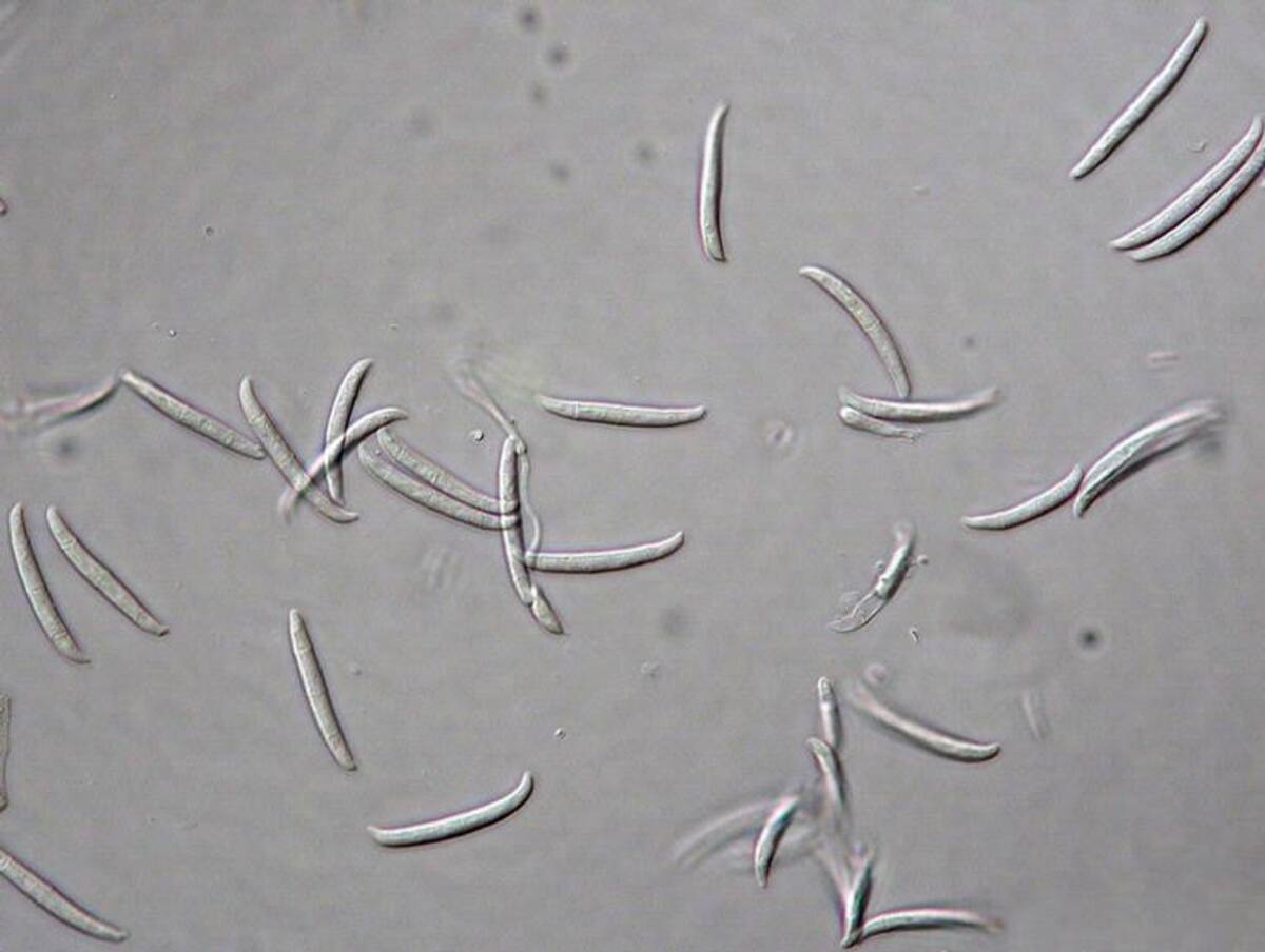 Fusarium Solani, hongo. Foto: Wikipedia