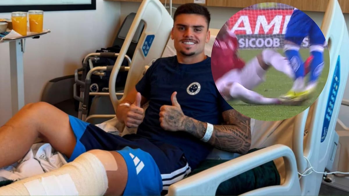 Castigo histórico en Brasil: suspendieron a un jugador hasta que se recupere el rival al que lesionó