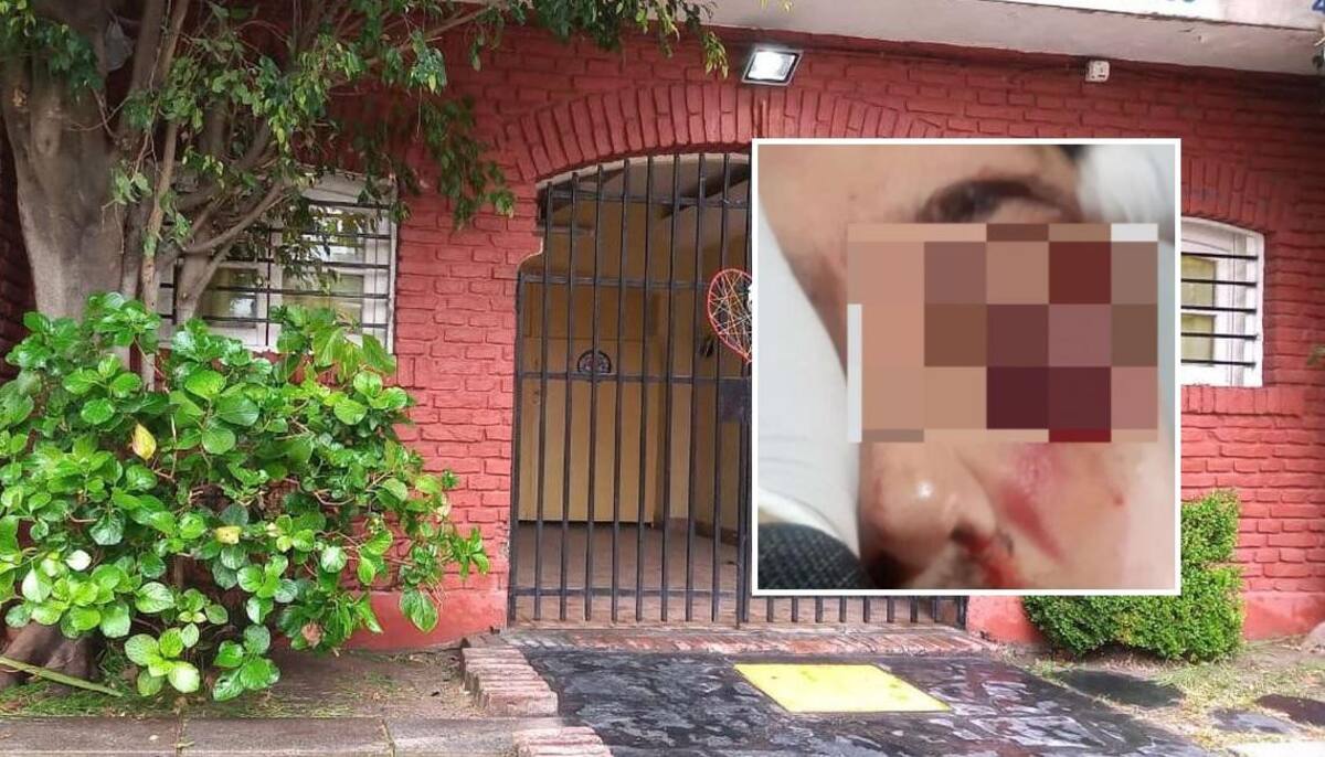 Habló la mujer del hombre golpeado tras una discusión en un