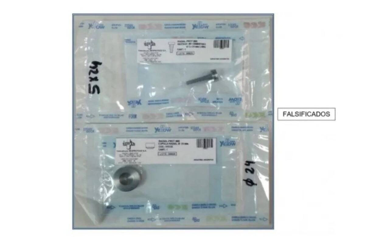 Implantes falsificados para codo. Foto: ANMAT