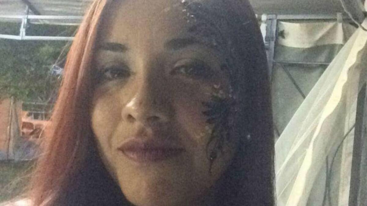 Johana Villafañe, argentina atacada por sus pitbull en Estados Unidos