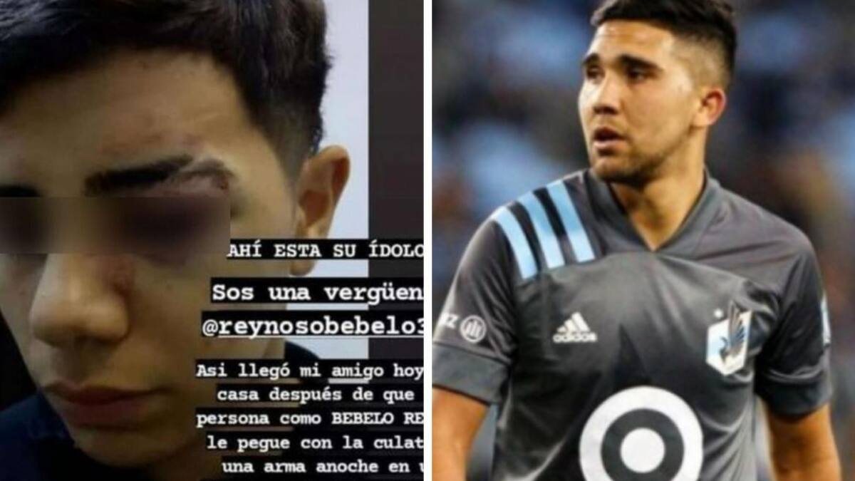 Joven agredido por el jugador "Bebelo" Reynoso