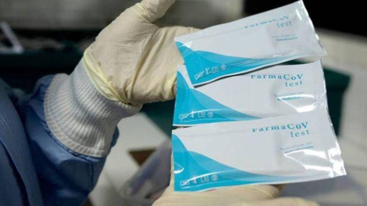 La ANMAT aprobó un test de coronavirus