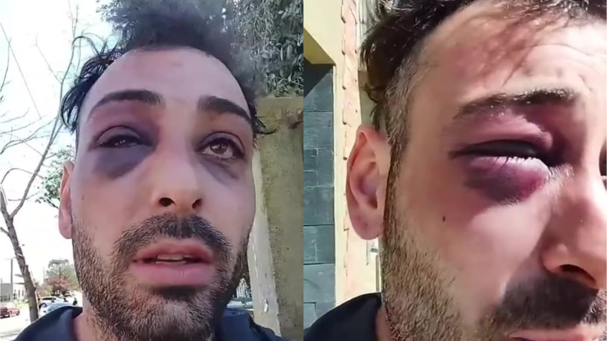 La Pampa: un joven fue salvajemente golpeado por la Policía: “Pensé que me iban a matar”