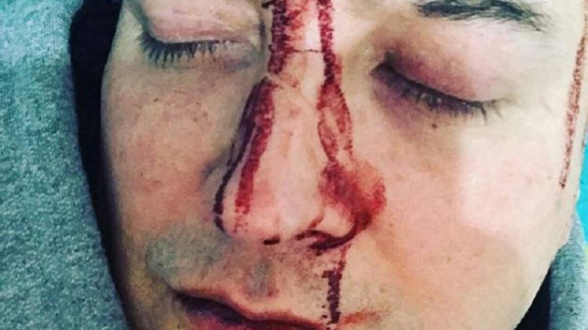 Leo García, cantante, agresión, foto Instagram