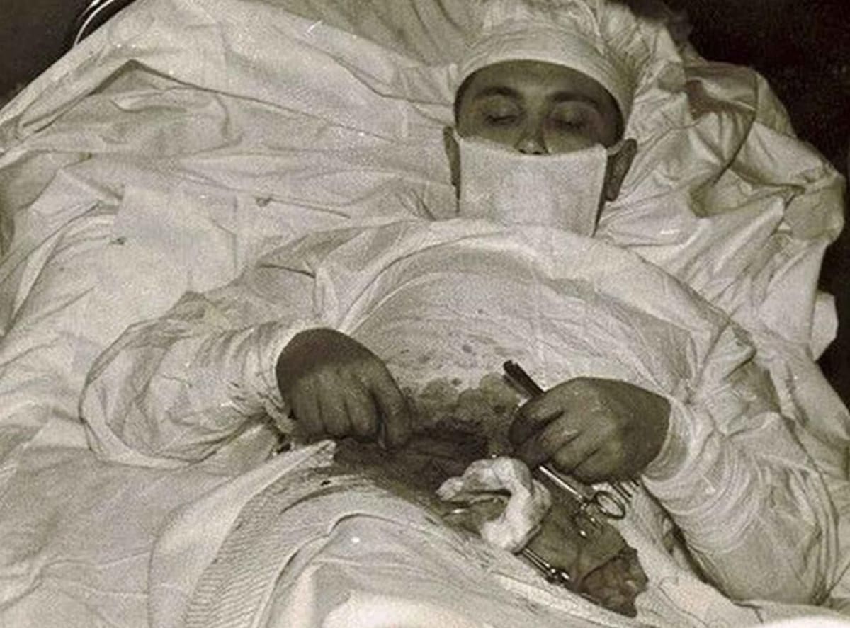 Leonid Rógozov, el médico cirujano que se operó a sí mismo