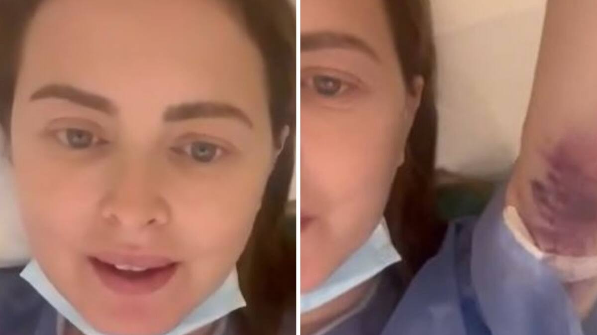 Los moretones que sufrió Silvina Luna durante su internación. Foto: captura de pantalla.