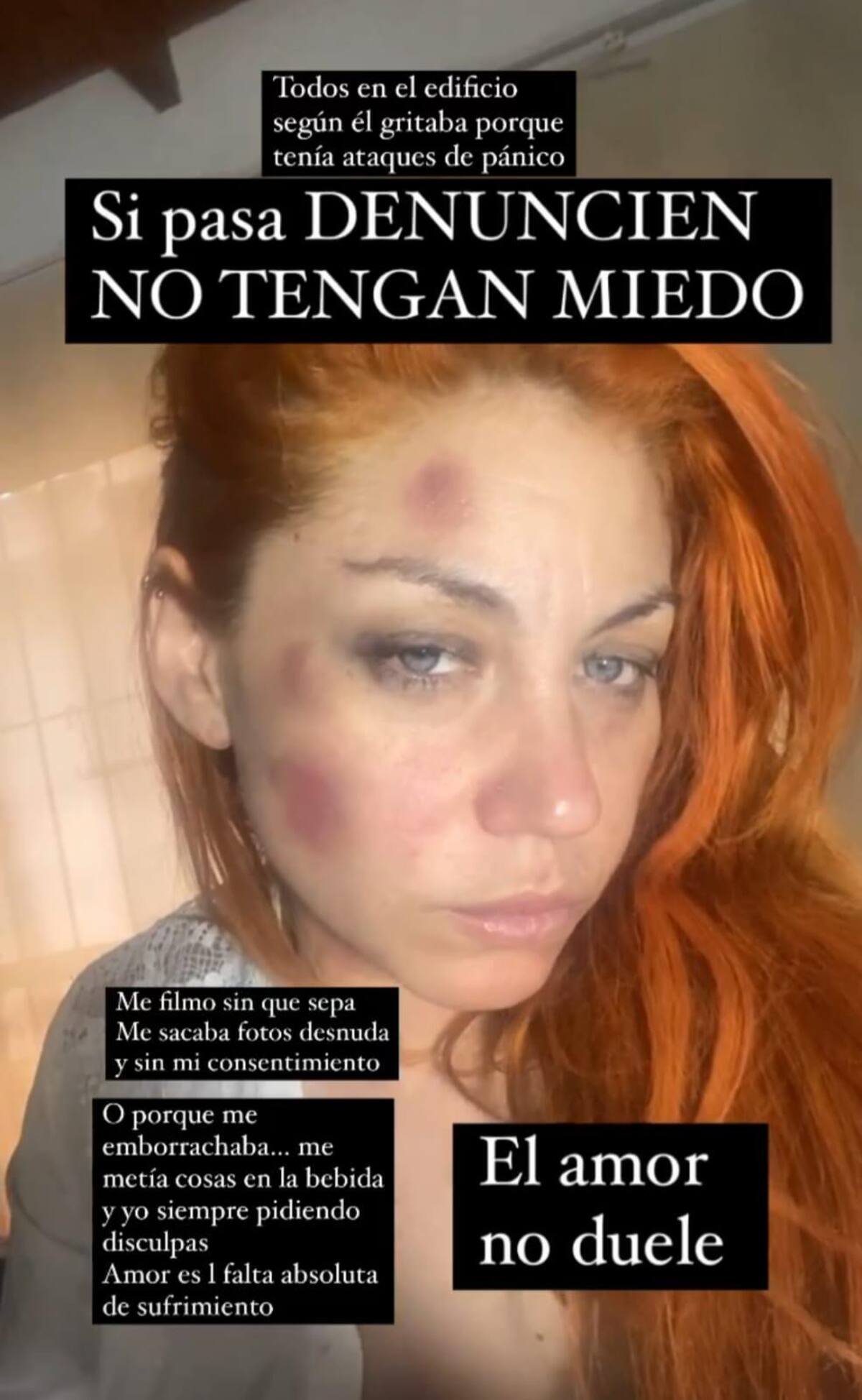 Lourdes de Bandana denunció un ataque de violencia de género. Foto: Instagram.