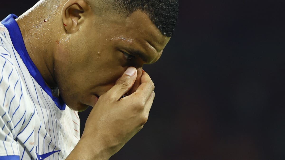 Mbappé se fracturó la nariz en el debut de Francia en la Eurocopa. Foto: Reuters