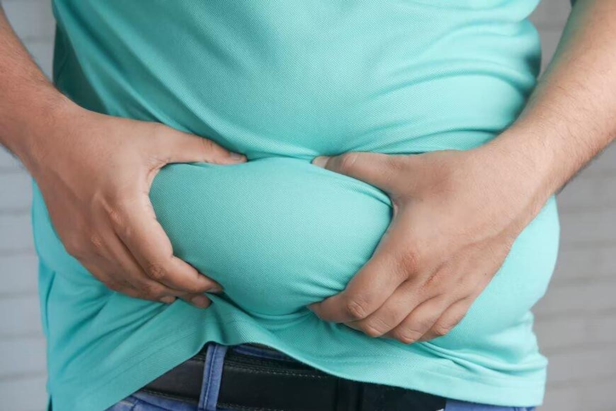 obesidad. Foto: Unsplash